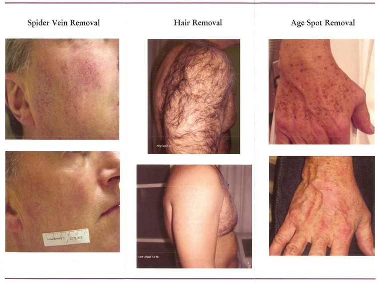 image for item 6535 Aesthetics at Stonecreek Family Physicians