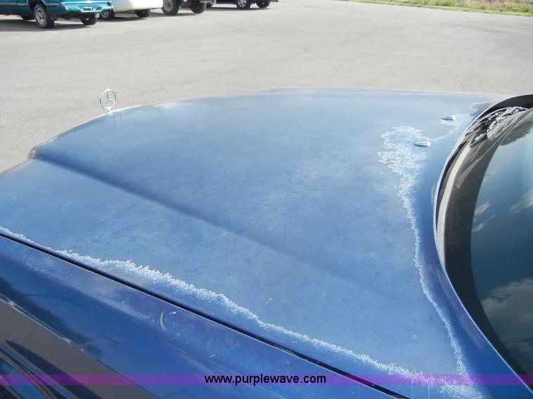 image for item D4241 1987 Mercedes Benz 300 SDL