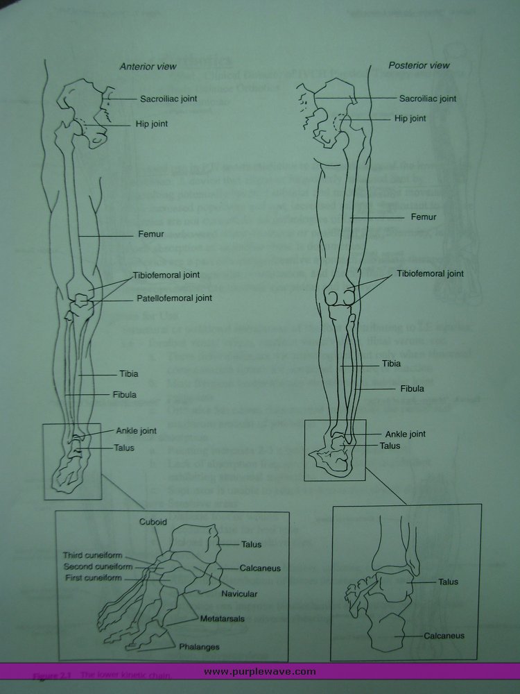 image for item 2024 Medical grade custom foot orthotics