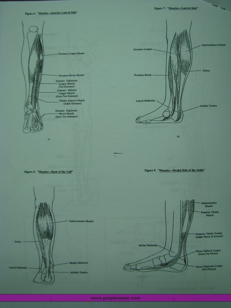 image for item 2024 Medical grade custom foot orthotics